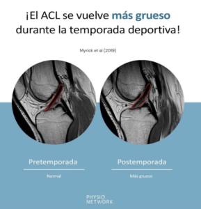 ACL más grueso durante la temporada deportivaC