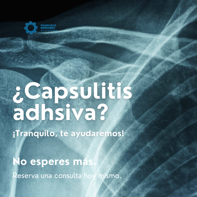 Clínica Francisco Bernabéu Capsulitis adhesiva